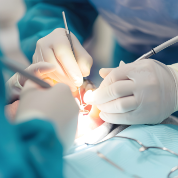 Clinica Dental Conde de Casal_Cirugia