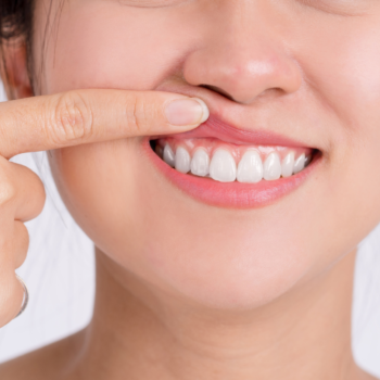 Clinica Dental Conde de Casal_Periodoncia